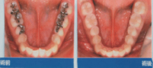 �Z���~�b�N���É摜