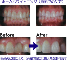 �z�|���z���C�g�j���O